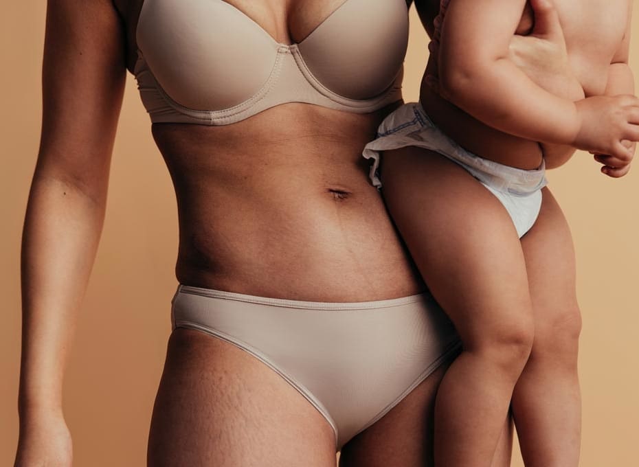 Close-up of a woman’s midriff after a mummy makeover holding her baby against a beige background